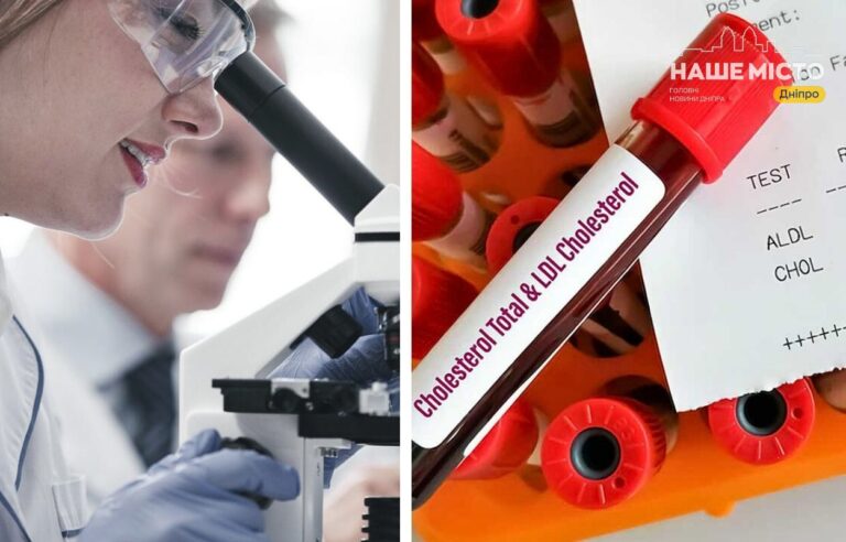 Як і де перевірити рівень холестерину у Дніпрі: повний гід