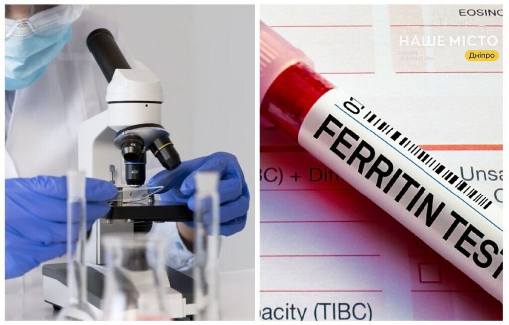 Де перевірити рівень феритину в Дніпрі: лабораторії та вартість