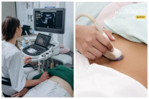 Важливість УЗД малого тазу для жінок у Дніпрі: де обстежитися?
