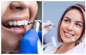 Професійне чищення зубів у Дніпрі: найкращі клініки та ціни