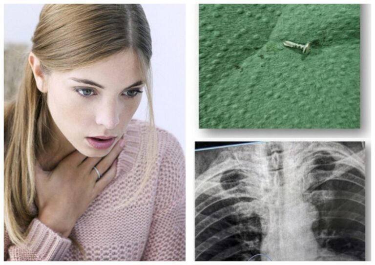 У Дніпрі лікарі успішно рятують пацієнтів зі сторонніми предметами в дихальних шляхах