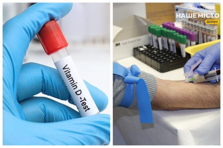 Аналіз на вітамін D у Дніпрі: де зробити та скільки коштує
