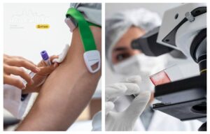 Де у Дніпрі здати аналіз на ліпідний профіль та скільки це коштує