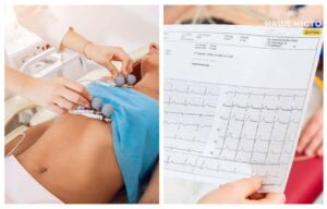 Де у Дніпрі зробити кардіограму: адреси та ціни