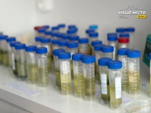 У дніпровських водоймах знайшли холероподібний вібріон: де небезпечно купатися